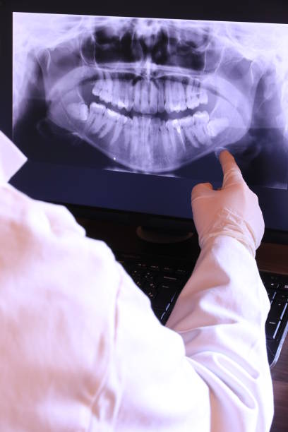 Best Knocked-Out Tooth (Avulsed Tooth) Treatment in Washington, KS